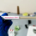 Un biologiste moléculaire prélève un échantillon de salive pour le test de mononucléose infectieuse