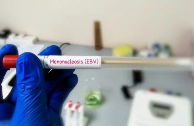 Un biologiste moléculaire prélève un échantillon de salive pour le test de mononucléose infectieuse